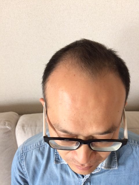 トシ頭上